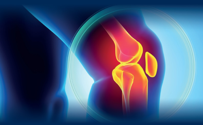 The Act-Flare Study Of Knee Pain